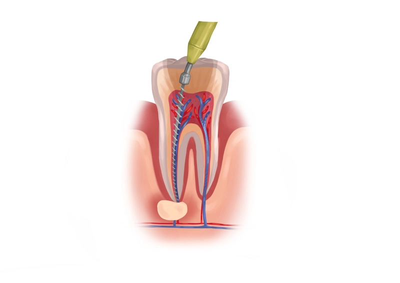 oprema za endodonciju
